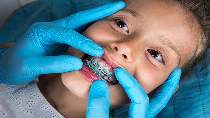 آیا کودکان نیز به کشیدن دندان ها نیاز دارند؟