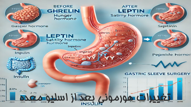 تغییرات هورمونی بعد از اسلیو معده