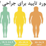 bmi مورد تایید برای جراحی لاغری