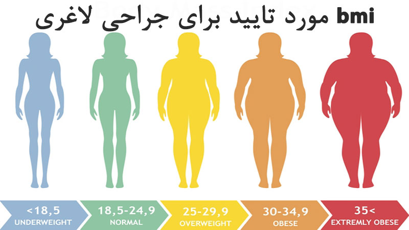 bmi مورد تایید برای جراحی لاغری