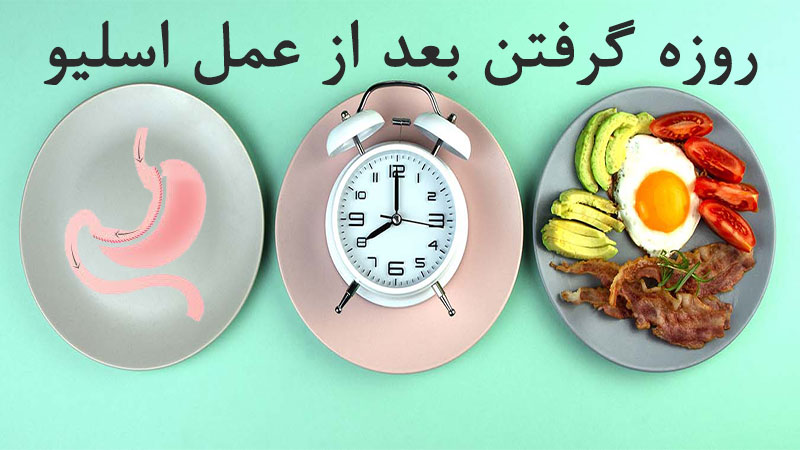 روزه گرفتن بعد از عمل اسلیو